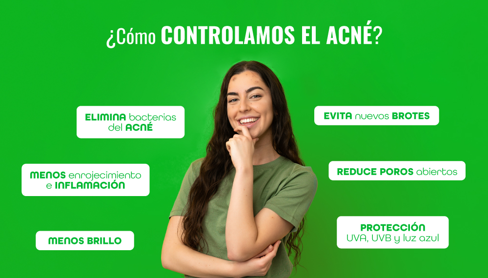 Beneficios antiacné