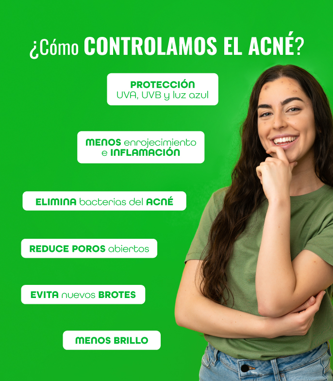 Beneficios antiacné